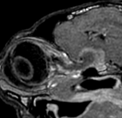 2nd Repetition (live) of Webinar Brain Nerves 1 - Olfactory, optic and oculomotor nerves - Tuesday, 14. 01. 2025, 18:30 to 20:00 CET