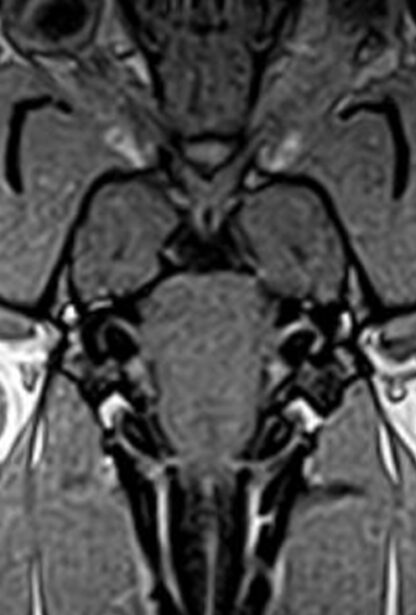 Webinar Brain Nerves 3 - Facial, vestibulocochlear, vagus, glossopharyngeal, accessory, hypoglossus nerves - date to be announced