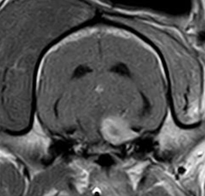 Webinar Brain Nerves 2 - Trochlear, trigeminal and abducens nerves - Tuesday, 28. 01. 2025, 18:30 to 20:00 CET